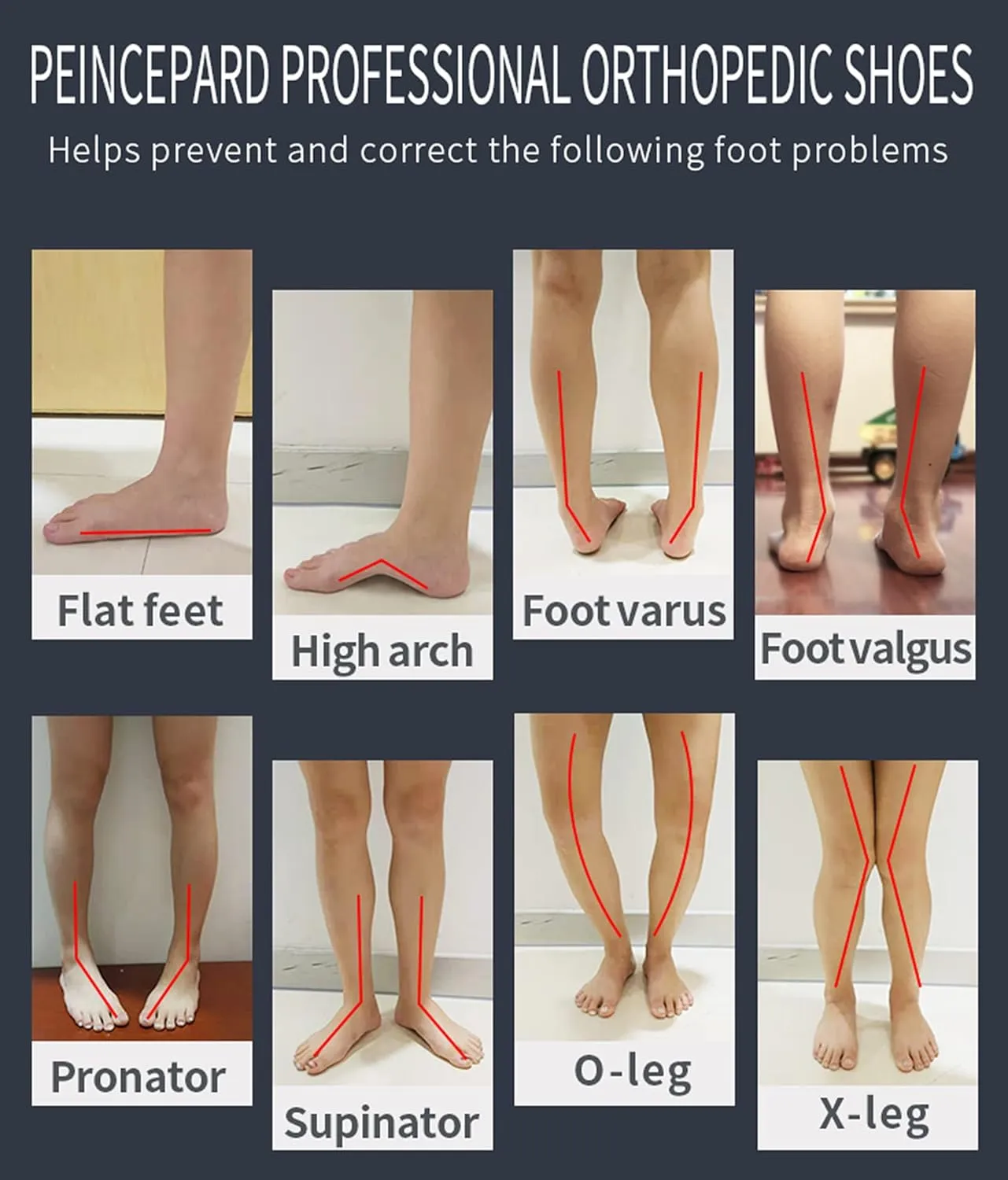 Kids Orthopedic Corrective Shoes for Boys and Girls'Foot Problems with Arch & Ankle Support,Anti-Slip Soles